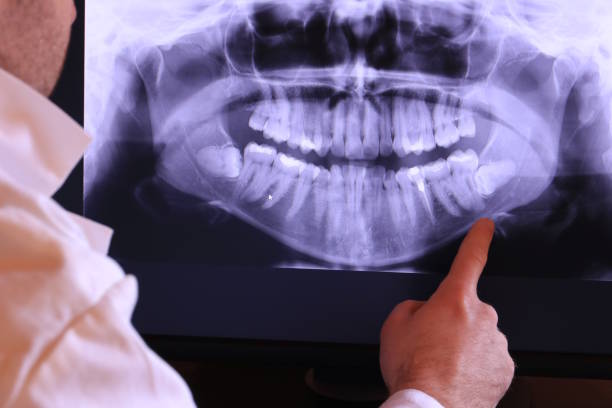 Best Emergency Dental Care for Trauma or Injury in Hamilton, IN