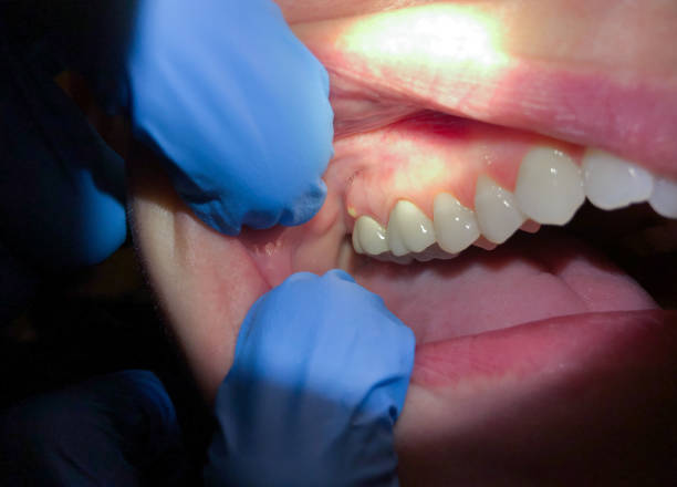 Best Walk-In Emergency Dentist in Hamilton, IN