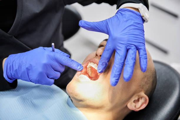 Best Emergency Root Canal Treatment in Hamilton, IN